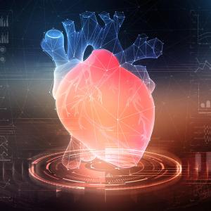 RA patients at high risk of degenerative valvular heart disease