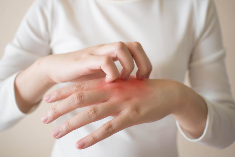 The selective oral Janus kinase 1 (JAK1) inhibitor ivarmacitinib helps improve the signs and symptoms of moderate-to-severe a