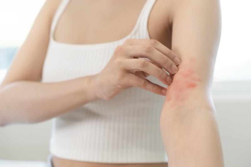 Abrocitinib, dupilumab restore skin barrier function in AD, but differ in proteomics