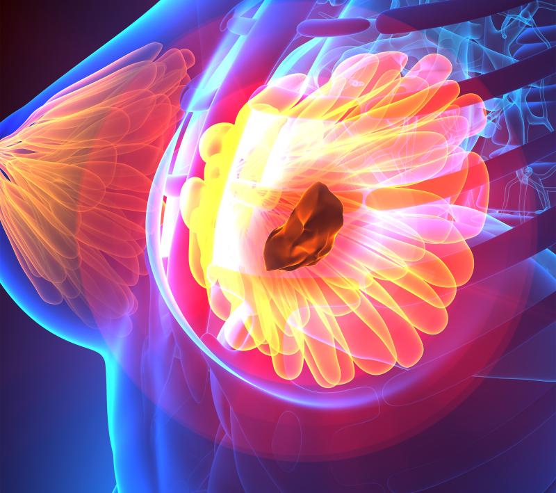 Dose reduction does not limit efficacy of trastuzumab deruxtecan in MBC
