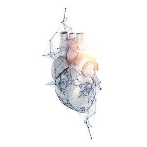 How does an AI-based angiography system fare in PCI?