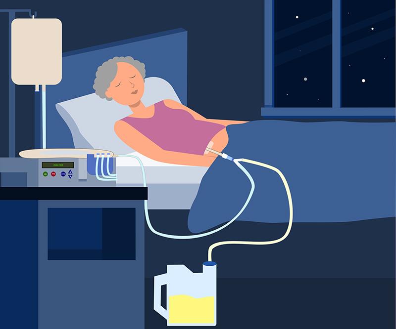 Analogue bests human insulin in T2D patients with kidney failure on peritoneal dialysis