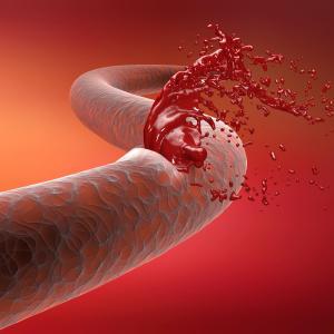 Is it safe to take abelacimab before a procedure?