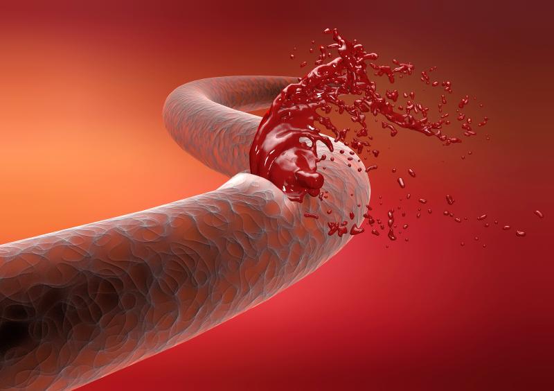 Is it safe to take abelacimab before a procedure?