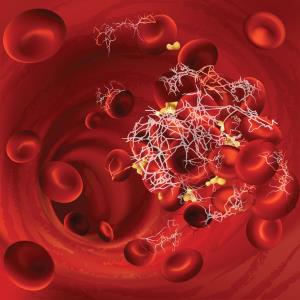 Low intensity heparin strategy safe for patients on ECMO
