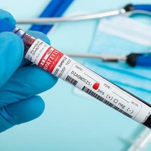 Antiviral therapy lowers HCC risk in indeterminate CHB phase