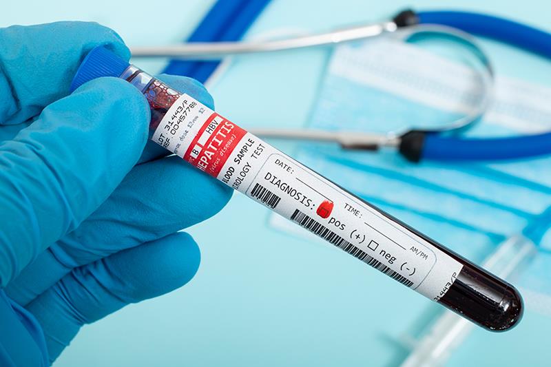 Antiviral therapy lowers HCC risk in CHB patients in indeterminate phase
