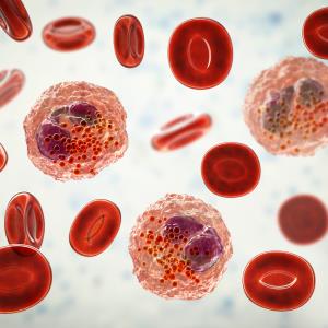 Anxiety, adaptive behaviours modify link between dysphagia, HDA in EoE