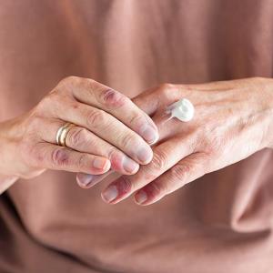 Delgocitinib cream works wonders in chronic hand eczema