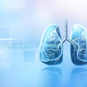 DeLLphi-304: Tarlatamab bests SoC chemo as 2L treatment for SCLC
