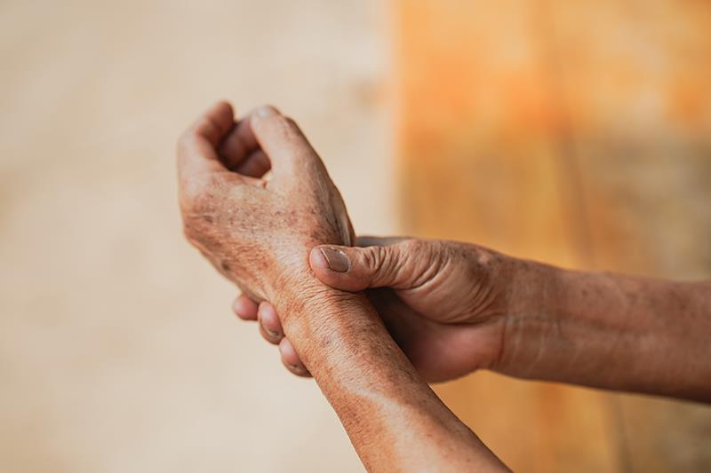 Deucravacitinib delivers long-term efficacy in psoriatic arthritis