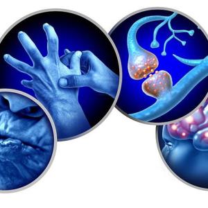 Deutetrabenazine for tardive dyskinesia yields favourable patient-reported outcomes