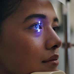 Direct SLT a feasible first-line treatment for glaucoma, ocular hypertension