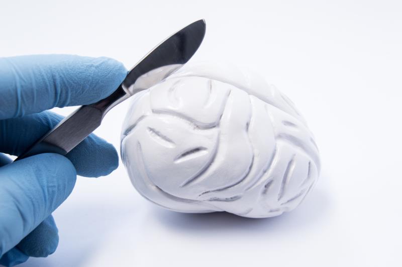What stops patients in SG from getting surgery for drug-resistant epilepsy?