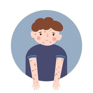Dupilumab improves disease severity, PROs in children with AD