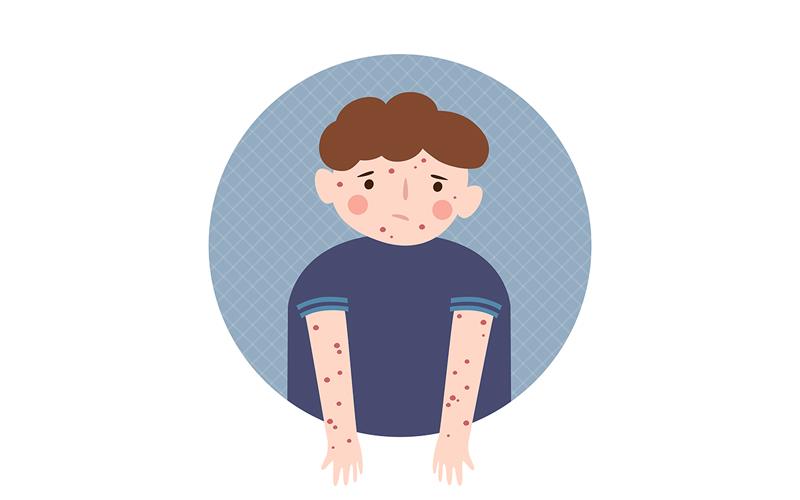 Dupilumab improves disease severity, PROs in children with AD