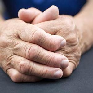 Baricitinib compares favourably with filgotinib for RA