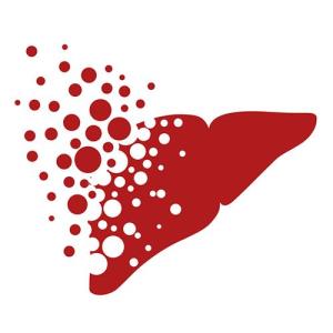 Are statins protective against HCC?