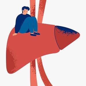 Efruxifermin reduces fibrosis in MASH cirrhosis