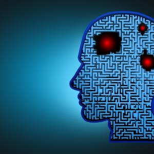 Brain bleed risk from unruptured arteriovenous malformations lower than previously thought