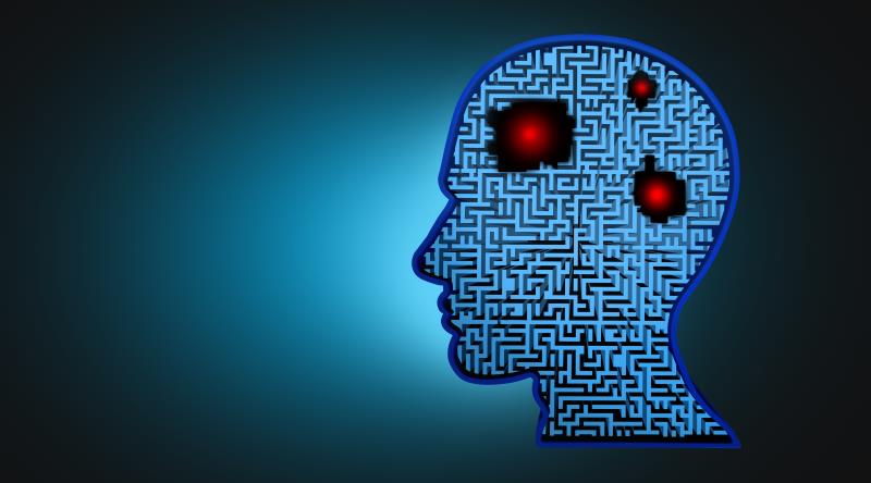 Brain bleed risk from unruptured arteriovenous malformations lower than previously thought