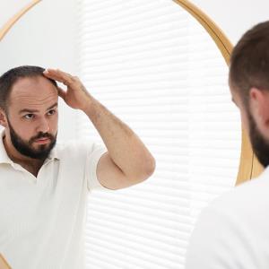 Extended-release minoxidil pill promotes hair growth in 4 months