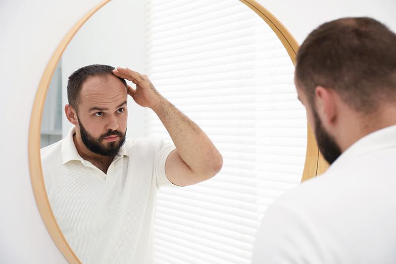 Extended-release minoxidil pill promotes hair growth in 4 months