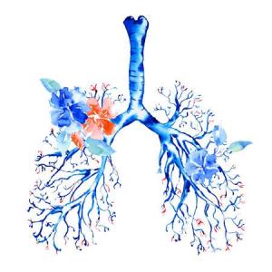 Nerandomilast slows IPF progression in patients already on antifibrotic therapy