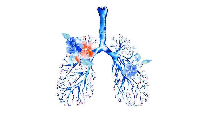 Nerandomilast slows IPF progression in patients already on antifibrotic therapy