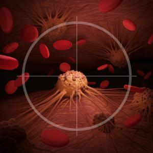 CAR T-cell therapy offers survival benefits in refractory B-cell ALL