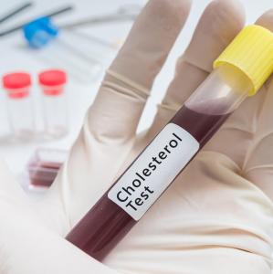 Familial hypercholesterolemia a risk factor for cerebral small vessel disease