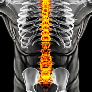 Degenerative disc disease in PsA patients tied to old age, back pain, male sex