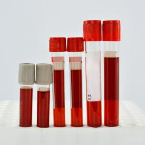 2-year changes in remnant cholesterol predictive of stroke