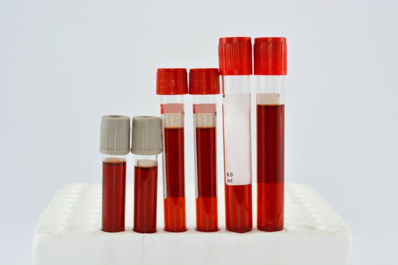 2-year changes in remnant cholesterol predictive of stroke