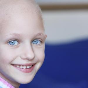 Androgenetic alopecia may develop in prepubertal patients