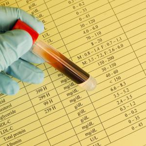 TyG index linked to hypertension incidence