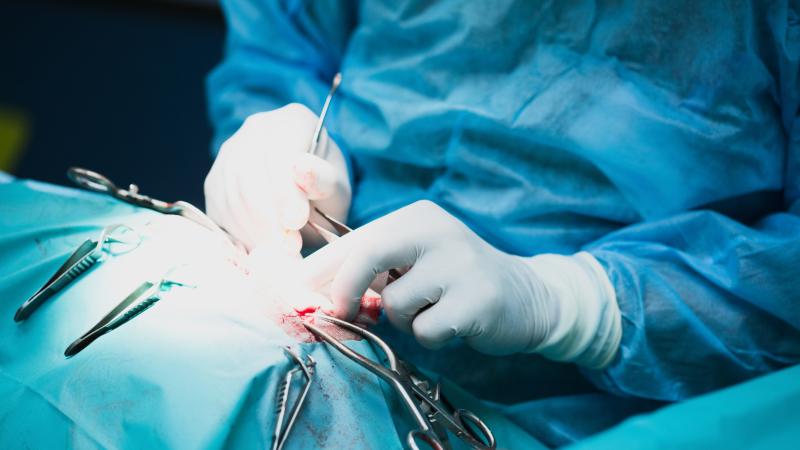 Midline extraction incision predicts risk of incisional hernia after nephrectomy