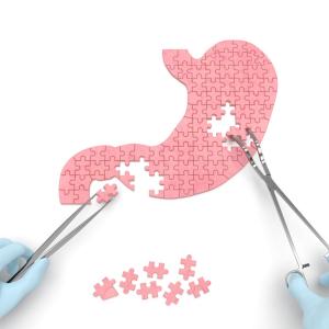 Outcomes after sleeve gastrectomy differ across race, ethnicities