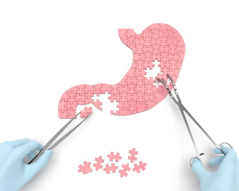 Outcomes after sleeve gastrectomy differ across race, ethnicities