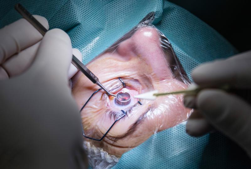 Synthetic tissue substitute tied to high patch exposure, surgical revision in glaucoma patients