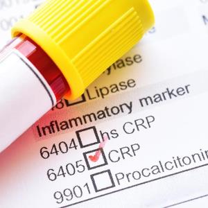 High CRP predicts risk of steroid-refractory ASUC