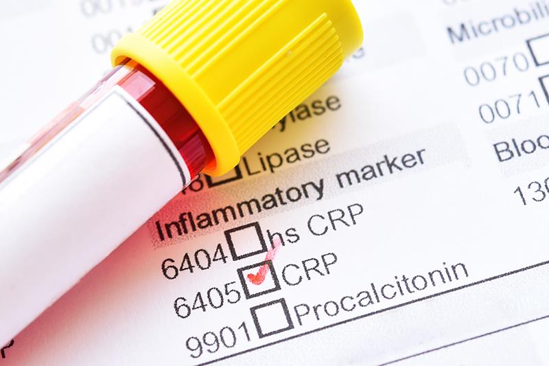 High CRP or CRP–albumin ratio on admission predicts risk of steroid-refractory ASUC