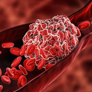 Prediction models show poor accuracy in stratifying VTE risk