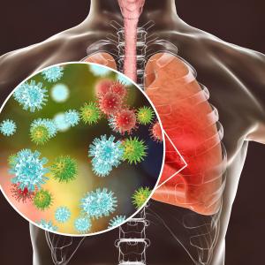Inhaled sedation with sevoflurane not beneficial in moderate-to-severe ARDS