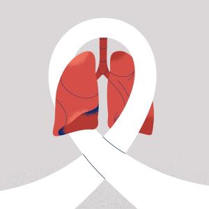 First-line osimertinib plus chemotherapy further extends PFS in advanced EGFR-mutated NSCLC