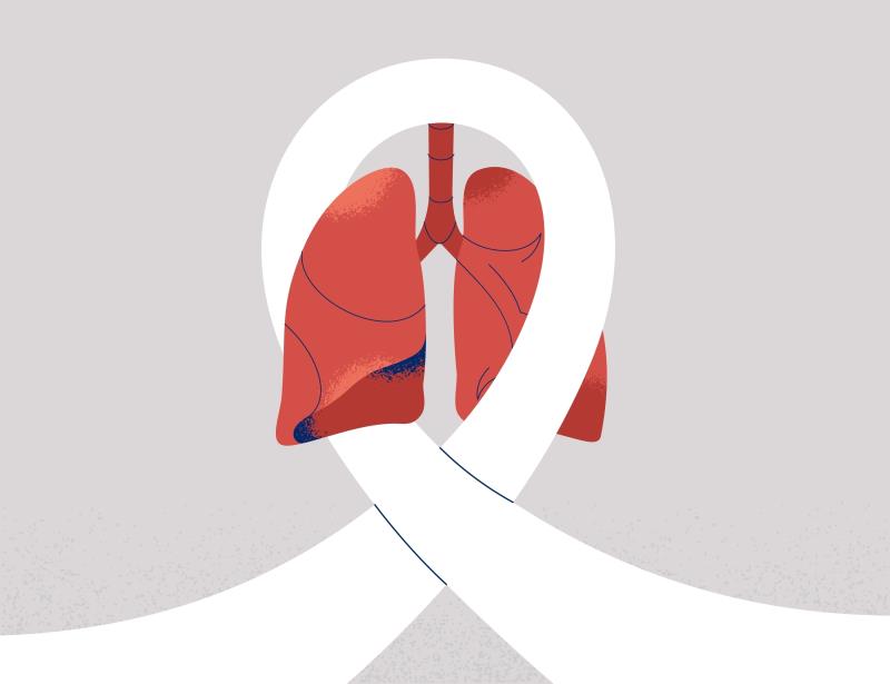 First-line osimertinib plus chemotherapy further extends PFS in advanced EGFR-mutated NSCLC