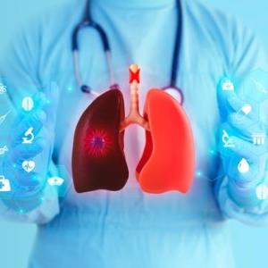 Select cases of advanced EGFR-mutated NSCLC with different disease burden treated with first-line osimertinib plus chemothera
