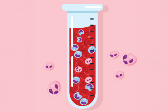 MRD response in two patients with AML treated with oral maintenance therapy