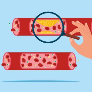 Closing LDL-C treatment gaps with nonstatin options: Insights from European registries
