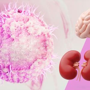 Herpes zoster encephalitis in two patients with kidney disease: Diagnostic and therapeutic challenges